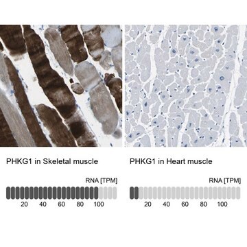 Anti-PHKG1 antibody produced in rabbit Prestige Antibodies&#174; Powered by Atlas Antibodies, affinity isolated antibody, buffered aqueous glycerol solution