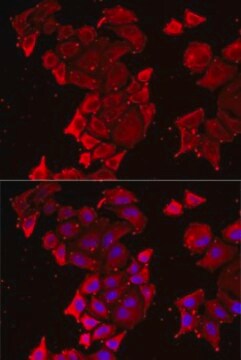 Anti-TIMM17A antibody produced in rabbit