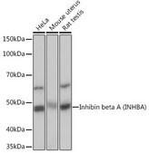 Anti-Inhibin beta A (INHBA) Antibody, clone 1X6N9, Rabbit Monoclonal