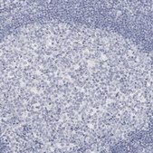 Anti-AGMAT antibody produced in rabbit Prestige Antibodies&#174; Powered by Atlas Antibodies, affinity isolated antibody, buffered aqueous glycerol solution