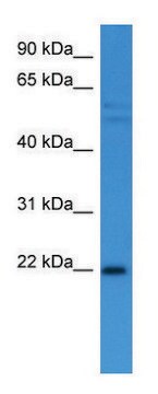 Anti-GADD45A (C-terminal) antibody produced in rabbit affinity isolated antibody