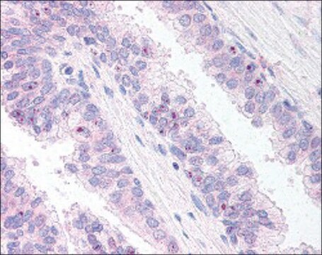 Anti-ERG antibody produced in goat affinity isolated antibody, buffered aqueous solution