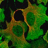 Anti-DPP3 antibody produced in rabbit Prestige Antibodies&#174; Powered by Atlas Antibodies, affinity isolated antibody, buffered aqueous glycerol solution