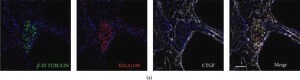 Monoclonal Anti-&#946;-Tubulin III antibody produced in mouse clone SDL.3D10, ascites fluid