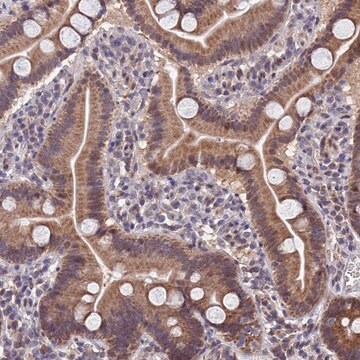 Anti-CYP2R1 antibody produced in rabbit Prestige Antibodies&#174; Powered by Atlas Antibodies, affinity isolated antibody, buffered aqueous glycerol solution