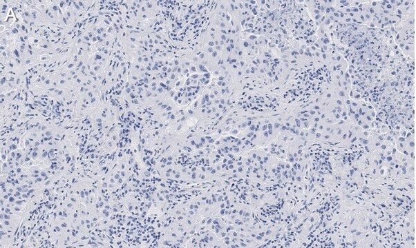 Anti-Integrin pan-&#945;V Antibody, clone EM01309 , ZooMAb&#174; Rabbit Monoclonal recombinant, expressed in HEK 293 cells