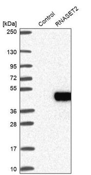 Anti-RNASET2 antibody produced in rabbit Prestige Antibodies&#174; Powered by Atlas Antibodies, affinity isolated antibody, buffered aqueous glycerol solution