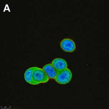 Anti-phospho-ULK1-Ser555 Antibody, clone 1E17 ZooMAb&#174; Rabbit Monoclonal recombinant, expressed in HEK 293 cells