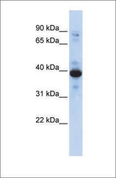 Anti-RNF34 antibody produced in rabbit affinity isolated antibody