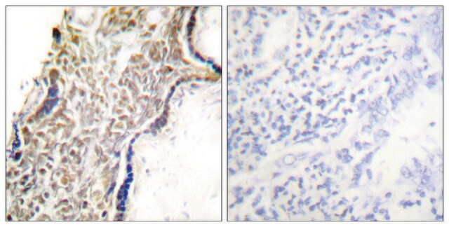 Anti-p14 ARF antibody produced in rabbit affinity isolated antibody