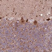 Anti-PHLDB1 antibody produced in rabbit Prestige Antibodies&#174; Powered by Atlas Antibodies, affinity isolated antibody, buffered aqueous glycerol solution