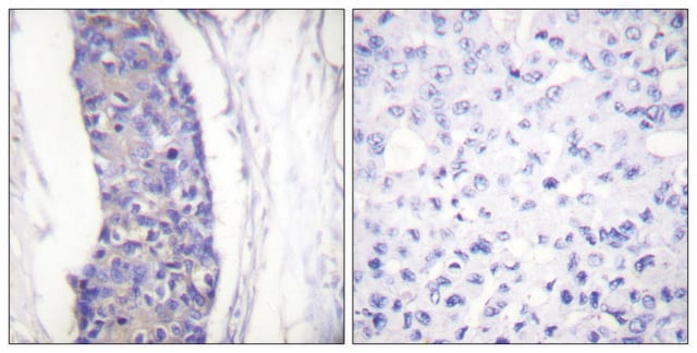 Anti-Tubulin &#945; antibody produced in rabbit affinity isolated antibody