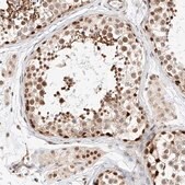 Anti-HDAC9 antibody produced in rabbit Prestige Antibodies&#174; Powered by Atlas Antibodies, affinity isolated antibody, buffered aqueous glycerol solution
