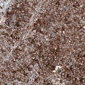 Anti-GSPT1 antibody produced in mouse Prestige Antibodies&#174; Powered by Atlas Antibodies, clone CL13332, purified by using Protein A, buffered aqueous glycerol solution