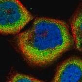 Anti-SLC9A5 antibody produced in rabbit Prestige Antibodies&#174; Powered by Atlas Antibodies, affinity isolated antibody, buffered aqueous glycerol solution