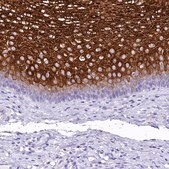 Anti-A2ML1 antibody produced in rabbit Prestige Antibodies&#174; Powered by Atlas Antibodies, affinity isolated antibody, buffered aqueous glycerol solution