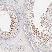 Anti-STAT4 antibody produced in rabbit Prestige Antibodies&#174; Powered by Atlas Antibodies, affinity isolated antibody, buffered aqueous glycerol solution