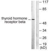 Anti-Thyroid Hormone Receptor &#946;, N-Terminal antibody produced in rabbit affinity isolated antibody