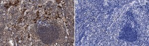 Anti-IL-6 Antibody, clone 1G18 ZooMAb&#174; Rabbit Monoclonal recombinant, expressed in HEK 293 cells