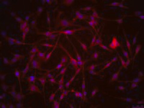 SMA-560 Mouse Orthotopic Glioma Cell Line SMA-560 cell line is a well-established glioma model derived from a spontaneous murine astrocytoma.