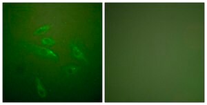 Anti-Collagen III antibody produced in rabbit affinity isolated antibody