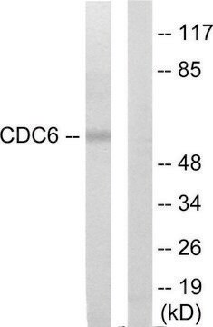 Anti-CDC6 antibody produced in rabbit affinity isolated antibody