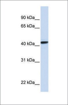 Anti-CLN8 (ab1) antibody produced in rabbit affinity isolated antibody