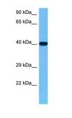 Anti-PRKACB antibody produced in rabbit affinity isolated antibody