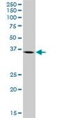 Anti-ARG2 antibody produced in mouse purified immunoglobulin, buffered aqueous solution