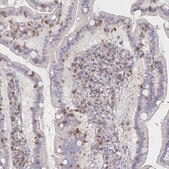 Anti-PIK3CD antibody produced in rabbit Prestige Antibodies&#174; Powered by Atlas Antibodies, affinity isolated antibody, buffered aqueous glycerol solution