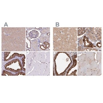 Anti-TPD52 antibody produced in rabbit Prestige Antibodies&#174; Powered by Atlas Antibodies, affinity isolated antibody, buffered aqueous glycerol solution