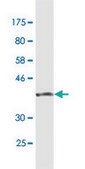 Monoclonal Anti-SUMO1 antibody produced in mouse clone 3D7, purified immunoglobulin, buffered aqueous solution
