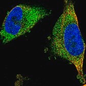 Anti-FNTA antibody produced in rabbit Prestige Antibodies&#174; Powered by Atlas Antibodies, affinity isolated antibody, buffered aqueous glycerol solution