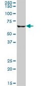 Anti-CPT2 antibody produced in mouse purified immunoglobulin, buffered aqueous solution