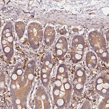 Anti-C6ORF136 antibody produced in rabbit Prestige Antibodies&#174; Powered by Atlas Antibodies, affinity isolated antibody, buffered aqueous glycerol solution