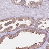 Anti-CYP19A1 antibody produced in rabbit Prestige Antibodies&#174; Powered by Atlas Antibodies, affinity isolated antibody, buffered aqueous glycerol solution