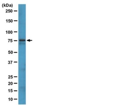 Anti-Bruton&#8242;s tyrosine kinase (Btk) Antibody, clone 10D11 clone 10D11, from mouse