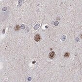 Anti-BCL11A antibody produced in rabbit Prestige Antibodies&#174; Powered by Atlas Antibodies, affinity isolated antibody, buffered aqueous glycerol solution