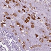 Anti-IGF2 antibody produced in rabbit Prestige Antibodies&#174; Powered by Atlas Antibodies, affinity isolated antibody, buffered aqueous glycerol solution