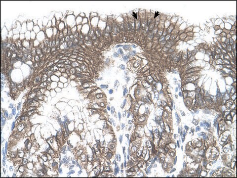 Anti-TARS antibody produced in rabbit IgG fraction of antiserum