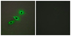Anti-Cytochrome P450 19A1 antibody produced in rabbit affinity isolated antibody