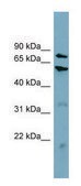Anti-CPT1B antibody produced in rabbit affinity isolated antibody