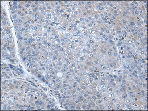 Anti-SCGB3A1 affinity isolated antibody