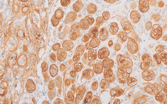 Somatostatin Receptor 2A (EP149) Rabbit Monoclonal Primary Antibody