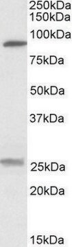 Anti-SLC4A11 antibody produced in goat affinity isolated antibody, buffered aqueous solution