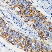 Anti-JAK1 Antibody, clone 7Q1B2, Rabbit Monoclonal