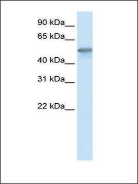 Anti-FOXO3A antibody produced in rabbit affinity isolated antibody