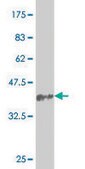 Monoclonal Anti-SNAI2 antibody produced in mouse clone 2F11, purified immunoglobulin, buffered aqueous solution