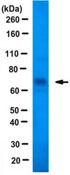 Anti-JMJD2E/KDM4E Antibody serum, from rabbit