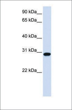 Anti-FOXR1 antibody produced in rabbit affinity isolated antibody